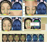 analizador facial 40W de la piel del escáner de la piel de la dermatología 3d de la máquina facial del análisis